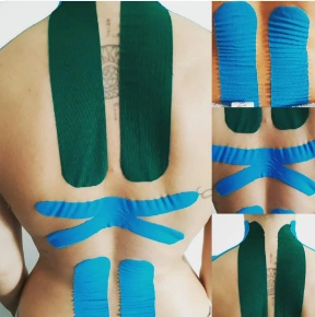 Il kinesio taping è quindi molto versatile e può essere utilizzato in tutte le articolazioni di braccia e gambe. Sul tronco e sul collo invece, viene impiegato prevalentemente per limitare i movimenti che possono arrecare disturbo a muscoli danneggiati da: contrattura, stiramento o strappo.